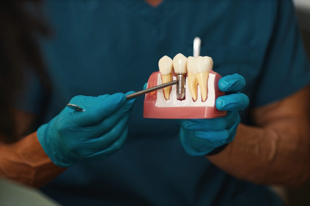 Dental Implants Nicholasville